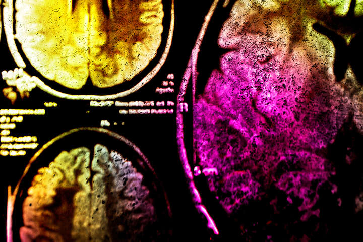 Вчені відкрили нову функцію дофаміну в мозку