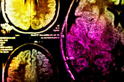 Вчені довели, що викиди дофаміну не можна пояснити тільки участю в системі винагороди