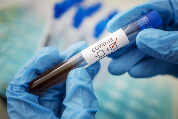 В Великобритании изобрели неожиданное лекарство от коронавирусной болезни 