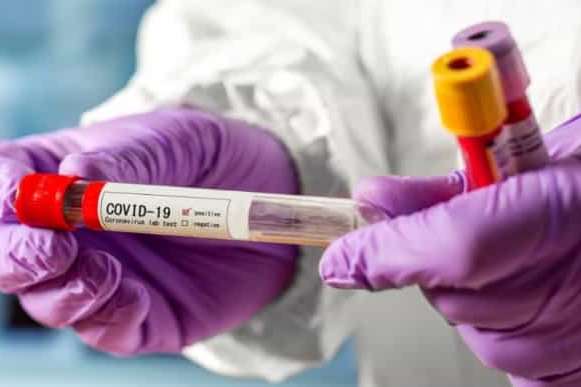 Науковці прогнозують суттєве зростання захворюваності на коронавірус в Україні 