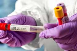 У нових пацієнтів з коронавірусом рідко фіксують втрату смаку і нюху 