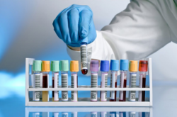  Определить причину пандемии, унесшей жизни более 4,7 млн человек во всем мире, со временем становится все сложнее 