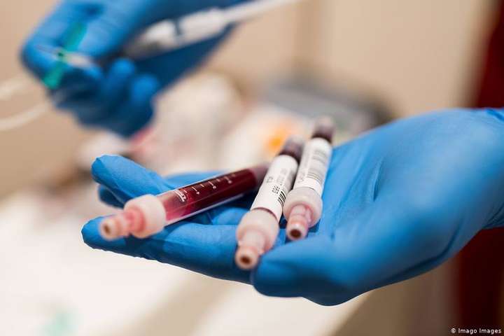 Аналіз крові здатен показати важкість перебігу коронавірусу – дослідження вчених