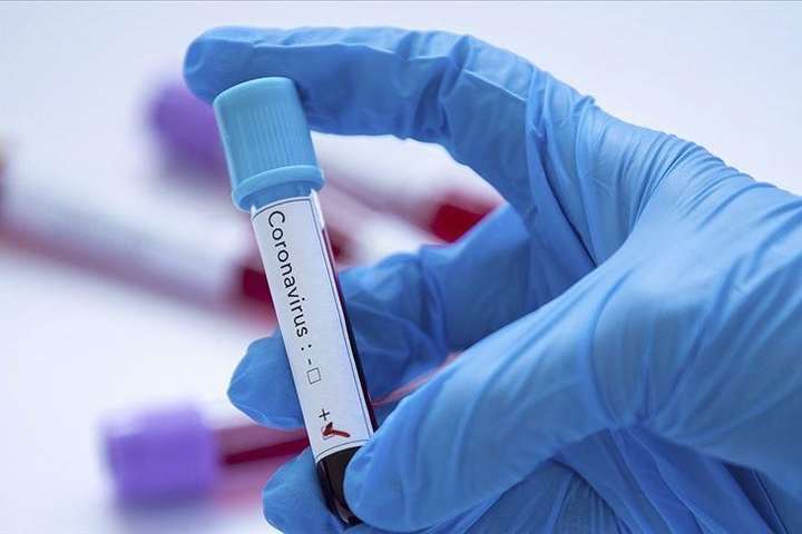 За минулу добу в Україні виявили понад 7 тис. нових заражень коронавірусом
