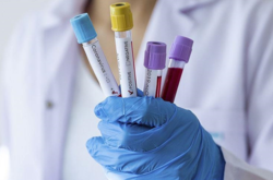 ВОЗ официально дала определение постковидному синдрому (перечень симптомов) 