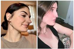 Долой все стандарты красоты! Фото людей, которые перестали стесняться своих носов и полюбили их