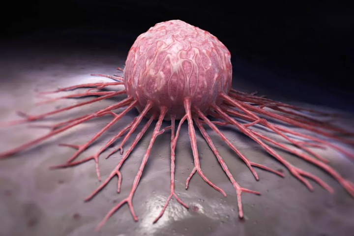 Медики научились диагностировать раковые опухоли по выдоху