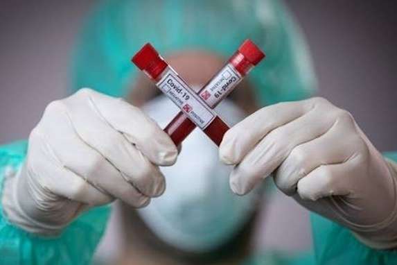 Імунітет до коронавірусу: медик розповів, скільки часу зберігаються антитіла 