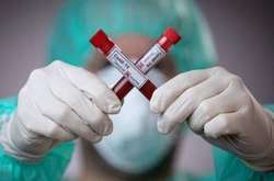 Вчені виявили ще один негативний наслідок Covid-19