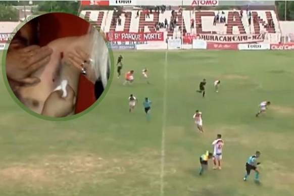 В Аргентині під час матчу підстрелили футбольного тренера