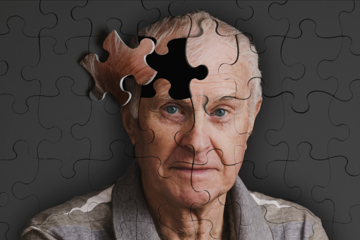 Ученые выявили причину прогрессирования болезни Альцгеймера 
