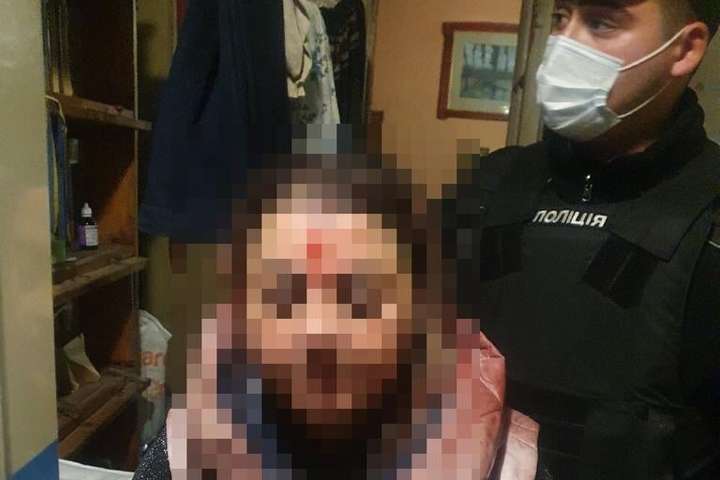 У Києві дві «соцпрацівниці» побили та забризкали газом пенсіонера (фото)