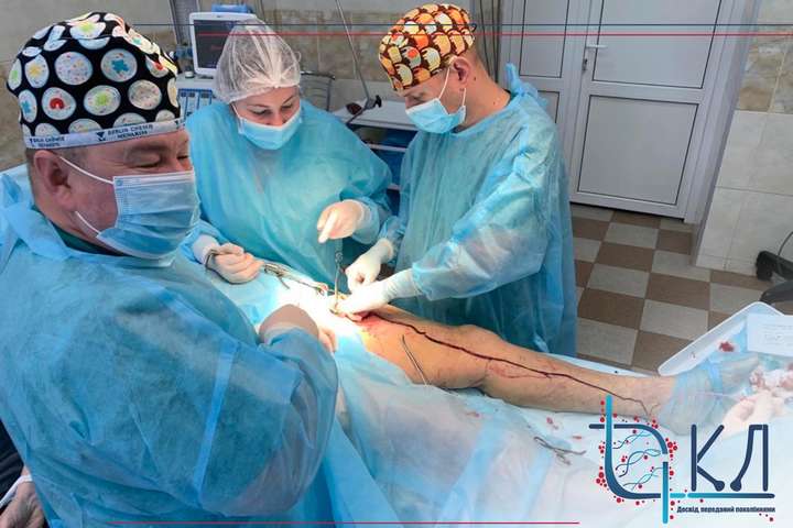 Із ноги пацієнтки, яка перехворіла на Covid-19, хірурги видалили метровий тромб