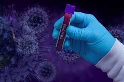 У Києві за минулу добу виявили 625 хворих на коронавірус