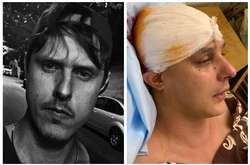 С такими травмами приезжают уже в коме. В Киеве жестоко избили известного музыканта