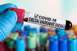 Ученые сообщили, сколько вариантов штамма коронавируса «Дельта» обнаружено в Украине 