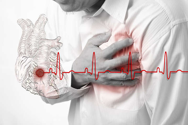 Covid-19 часто становится причиной сердечных приступов: разъяснение Минздрава 