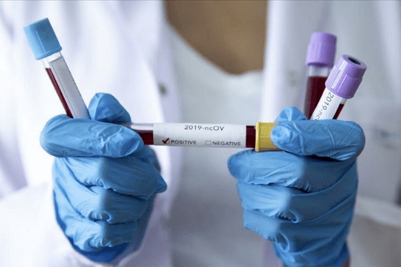 Ізраїльські вчені навчилися знищувати коронавірус за дві секунди 