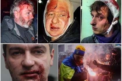 З листопада 2013-го по лютий 2014-го постраждало 160 журналістів. Двоє були забиті насмерть - Ніч, коли Україна втратила сон