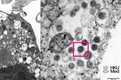 Ученым удалось сфотографировать «Омикрон»