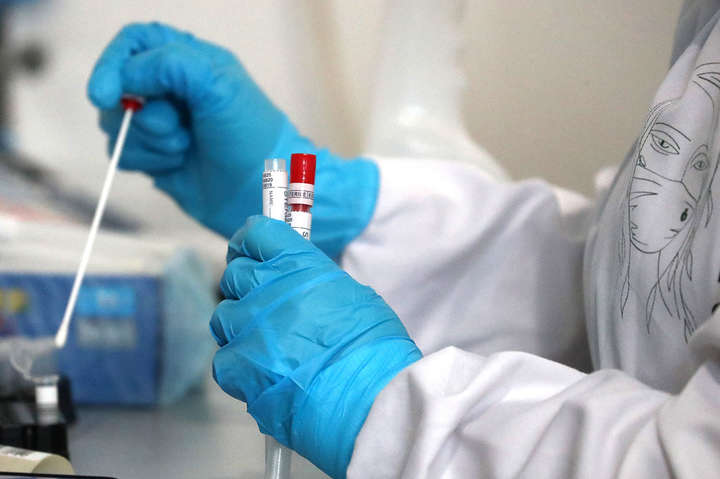 Вчені визначили маркери в крові, що впливають на смертність від коронавірусу