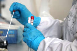 Вчені визначили маркери в крові, що впливають на смертність від коронавірусу