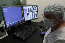 Німецькі та голландські вчені: коронавірус викликає появу рубців у нирках