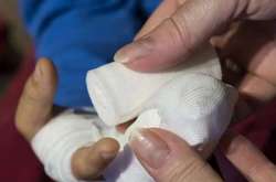 Перша жертва феєрверків: у Дніпрі чоловікові петардою відірвало палець