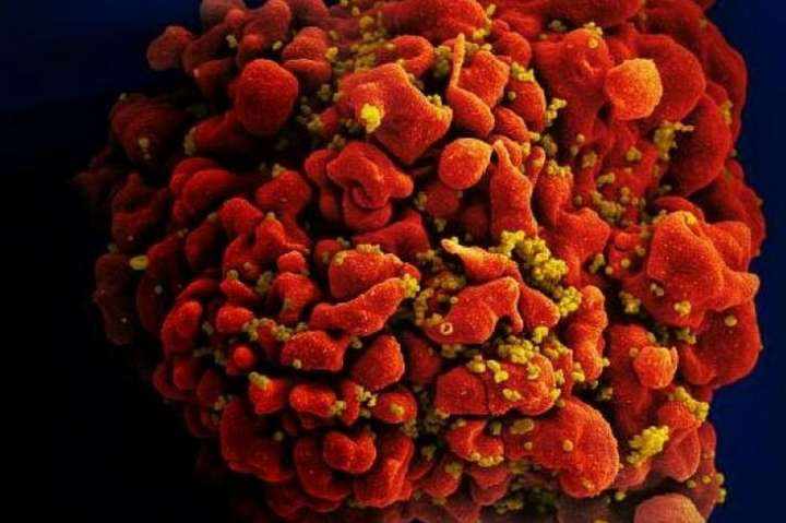 Вчені виявили у Нідерландах новий штам ВІЛ