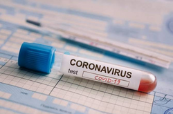 У Києві за добу зафіксовано понад 3 тис. випадків коронавірусу
