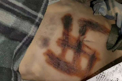 Выжгли свастику на теле. МВД рассказало, как рашисты пытали девушку под Киевом