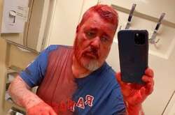 Напад на Нобелівського лауреата в Росії. Стали відомі виконавці та причина 