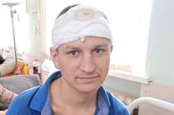 У лікарні Кривого Рогу поранений окупант вдавав українця, який втратив пам'ять 