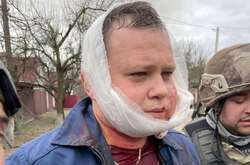 Усі побачили справжнє обличчя російських окупантів