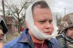 Все увидели настоящее лицо русских оккупантов