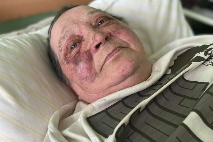 Росіяни жорстоко побили 70-річну волонтерку з Херсона (фото)