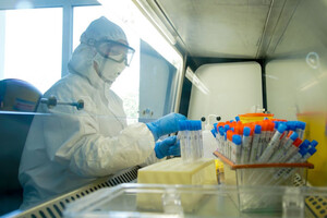 Вчені розповіли, коли чекати спалах мавп'ячої віспи