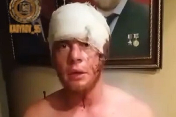 Полонений боєць ЗСУ в лице кадировцю безстрашно заявив, що патріот (відео)