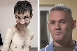 Обличчя так званих російських страждальців порівняли із станом захисника Маріуполя