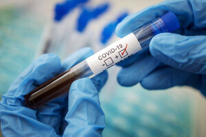 В течение недели в Украине инфицировались коронавирусом 22 914 человек