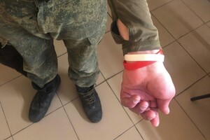 В Україні вже виявлено полонених бойовиків з ВІЛ та гепатитом