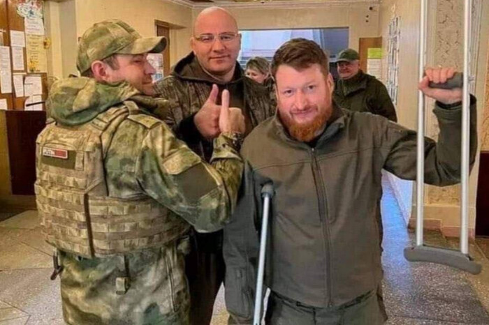 Російському пропагандисту, який став на міну, ампутували частину ноги