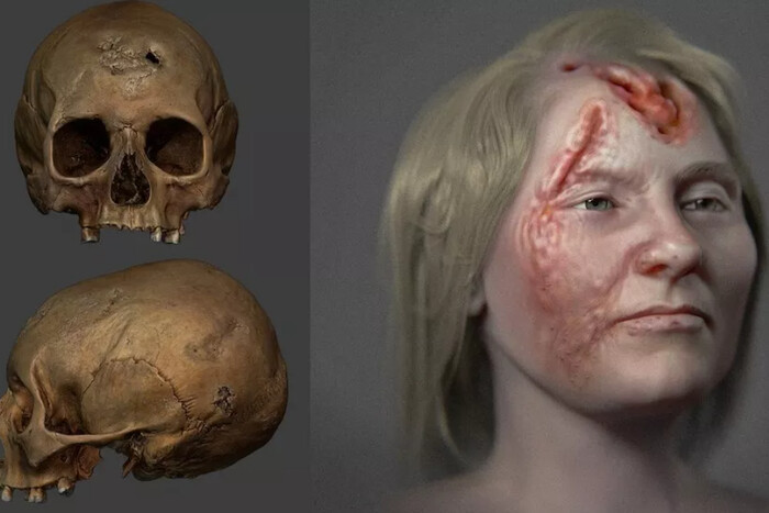 Дослідникам вдалось відтворити зовнішність хворої жінки, яка жила у XVI столітті