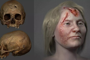 Дослідникам вдалось відтворити зовнішність хворої жінки, яка жила у XVI столітті