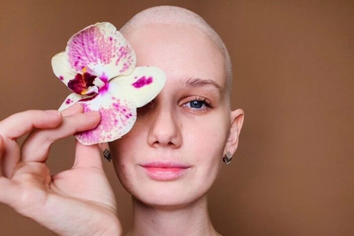 «Абсолютно випадково знайшла пухлину». Це жінки, які борються з раком під час війни