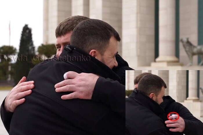 Кадыров носит на пальце странный датчик (видео)
