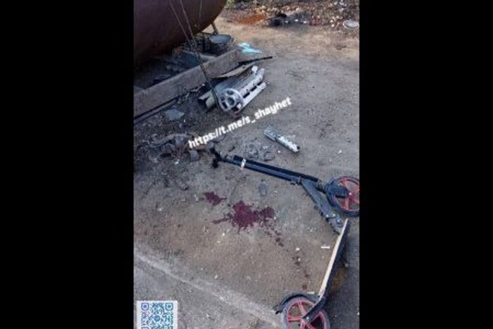 На Миколаївщині чоловік приніс на подвір’я вибуховий снаряд: постраждала дитина (фото)