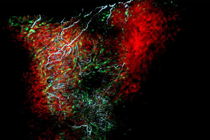 Уперше науковці зафільмували, як мозок очищається від мертвих нейронів (відео)