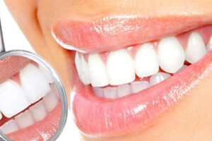 Стоматологи назвали продукти, які руйнують зубну емаль