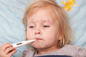Діти віком до шести років повинні мати одну дозу вакцини, після шести – потрібно ввести наступну
